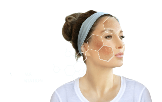 Pigmentation Treatments