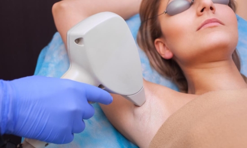 Everything You Need to Know Before Trying Laser Hair Removal