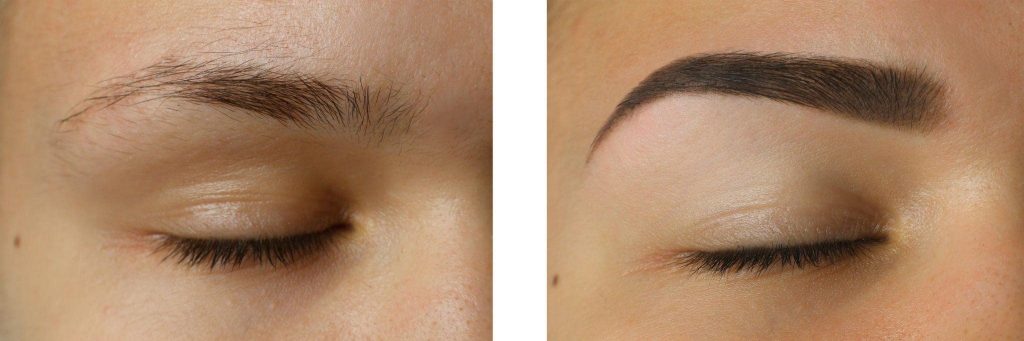 Microblading and micorneedling