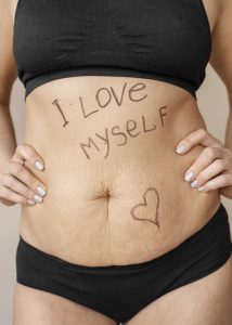 Pregnancy Stretch Mark